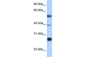 Western Blotting (WB) image for anti-MAX Dimerization Protein 3 (MXD3) antibody (ABIN2461943) (MXD3 anticorps)