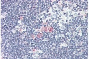 Human Thymus (formalin-fixed, paraffin-embedded) stained with CXCL12 antibody ABIN337163 at 5 ug/ml followed by biotinylated goat anti-rabbit IgG secondary antibody ABIN481713, alkaline phosphatase-streptavidin and chromogen. (CXCL12 anticorps)
