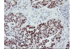 Image no. 8 for anti-Tumor Protein P53 (TP53) antibody (ABIN1499967) (p53 anticorps)