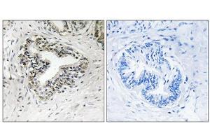 Immunohistochemistry analysis of paraffin-embedded human prostate carcinoma tissue using RPL30 antibody. (RPL30 anticorps  (C-Term))