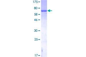 Image no. 1 for Glial Fibrillary Acidic Protein (GFAP) (AA 1-432) protein (GST tag) (ABIN1355007)