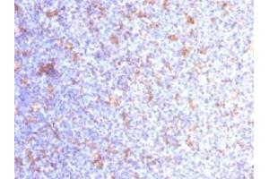 IHC testing of FFPE human tonsil with CD11c antibody (clone ITGAX/1284).