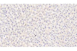 Detection of CPA1 in Rat Liver Tissue using Polyclonal Antibody to Carboxypeptidase A1, Pancreatic (CPA1)