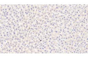 Detection of CPA1 in Rat Liver Tissue using Polyclonal Antibody to Carboxypeptidase A1, Pancreatic (CPA1) (CPA1 anticorps  (AA 205-419))