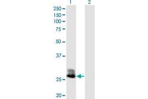 Western Blot analysis of CFHR2 expression in transfected 293T cell line by CFHR2 MaxPab polyclonal antibody. (CFHR2 anticorps  (AA 1-270))
