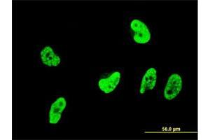 Immunofluorescence of monoclonal antibody to OXSR1 on HeLa cell. (OXSR1 anticorps  (AA 351-450))