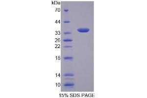 SDS-PAGE analysis of Human CTP Protein. (Slc25a1 Protéine)