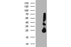 Western Blotting (WB) image for anti-Metalloproteinase Inhibitor 2 (TIMP2) antibody (ABIN1501394) (TIMP2 anticorps)