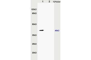 L1 rat kidney lysates L2 rat brain lysates probed with Anti ZNF379/ZDHHC9 Polyclonal Antibody, Unconjugated (ABIN715676) at 1:200 in 4 °C. (ZDHHC9 anticorps  (AA 118-155))