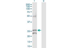 Western Blot analysis of GJB5 expression in transfected 293T cell line by GJB5 MaxPab polyclonal antibody.
