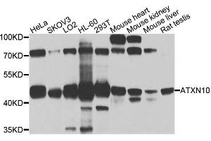 Western blot analysis of extracts of various cell lines, using ATXN10 antibody (ABIN5972628) at 1/1000 dilution. (Ataxin 10 anticorps)