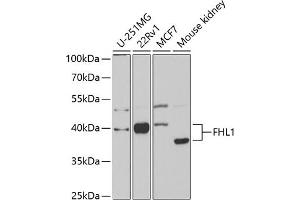 Western blot analysis of extracts of various cell lines, using FHL1 antibody (ABIN6127897, ABIN6140628, ABIN6140629 and ABIN6221119) at 1:1000 dilution.