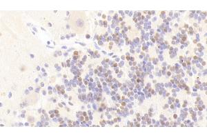 Detection of ANP32A in Human Cerebellum Tissue using Polyclonal Antibody to Acidic Nuclear Phosphoprotein 32 Family, Member A (ANP32A)
