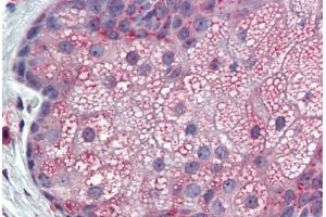 Anti-TM9SF3 antibody IHC staining of skin, sebaceous gland, human.