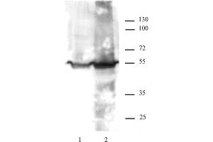 KLF4 antibody tested by Western blot. (KLF4 anticorps)
