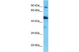 Host:  Rabbit  Target Name:  NSUN2  Sample Type:  PANC1 Whole Cell lysates  Antibody Dilution:  1. (NSUN2 anticorps  (N-Term))