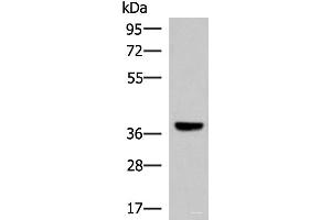 Western blot analysis of Mouse liver tissue lysate using LRG1 Polyclonal Antibody at dilution of 1:1000 (LRG1 anticorps)