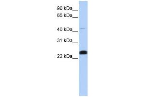 WB Suggested Anti-LYCAT Antibody Titration:  0. (LCLAT1 anticorps  (Middle Region))