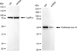 Western blotting analysis using forkhead box A1 antibody (ABIN7798641).