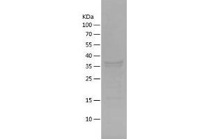 Western Blotting (WB) image for Keratin 20 (KRT20) (AA 1-139) protein (His-IF2DI Tag) (ABIN7123675)