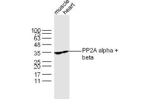 Lane 1: Muscle lysates Lane 2: Heart lysates probed with PP2A alpha + beta Polyclonal Antibody, Unconjugated  at 1:300 dilution and 4˚C overnight incubation. (PP2A alpha/beta anticorps  (AA 205-309))