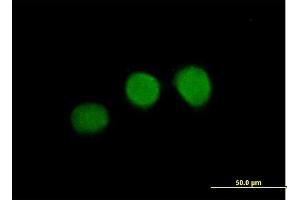 Immunofluorescence of purified MaxPab antibody to WDR45 on HeLa cell.