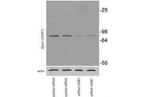 Western Blotting (WB) image for anti-Synovial Apoptosis Inhibitor 1, Synoviolin (SYVN1) antibody (ABIN2995229) (SYVN1 anticorps)