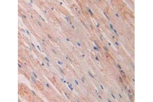 IHC-P analysis of Rat Tissue, with DAB staining. (NPPA anticorps  (AA 25-122))