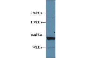 Western Blot; Sample: Human Liver lysate; Primary Ab: 1µg/ml Rabbit Anti-Human PYGL Antibody Second Ab: 0.