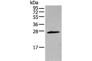 Western blot analysis of Jurkat cell using ZNF22 Polyclonal Antibody at dilution of 1:400 (Zinc Finger Protein 22 anticorps)