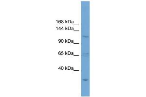 WB Suggested Anti-ZNF624 Antibody Titration: 0. (ZNF624 anticorps  (N-Term))