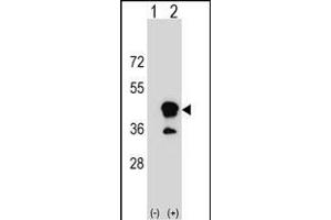 Western blot analysis of CD1B (arrow) using rabbit polyclonal CD1B Antibody (N-term) (ABIN1539475 and ABIN2849952). (CD1b anticorps  (N-Term))