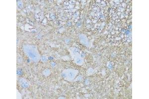 Immunohistochemistry of paraffin-embedded Mouse spinal cord using ATP1B2 Polyclonal Antibody at dilution of 1:100 (40x lens). (ATP1B2 anticorps)