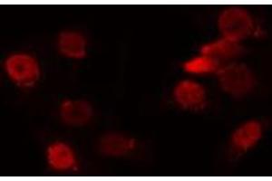 ABIN6272354 staining HuvEc by IF/ICC. (NANOGP8 anticorps)