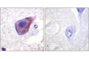 Immunohistochemistry analysis of paraffin-embedded human brain tissue, using Gz-alpha (Ab-16) Antibody.