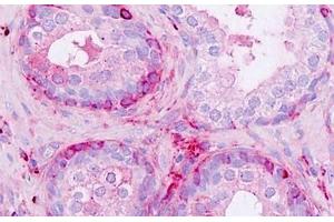 Human Prostate: Formalin-Fixed, Paraffin-Embedded (FFPE) (NPDC1 anticorps  (AA 189-238))