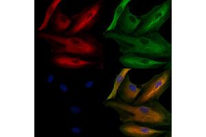 ABIN6259863 and ABIN6279104 staining  cells by IF/ICC.