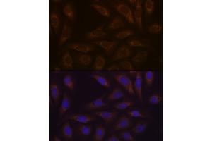 Immunofluorescence analysis of U-2 OS cells using DCP1A Rabbit mAb (ABIN7266678) at dilution of 1:100 (40x lens). (DCP1A anticorps)
