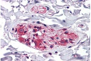 Human Colon: Formalin-Fixed, Paraffin-Embedded (FFPE)