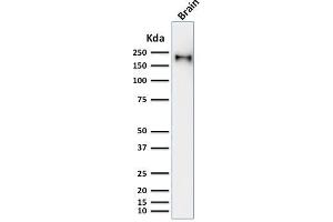 anti-Neurofilament, Heavy Polypeptide (NEFH) antibody