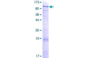 Image no. 1 for Protein Inhibitor of Activated STAT, 3 (PIAS3) (AA 1-619) protein (GST tag) (ABIN1314993)