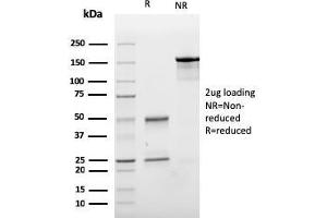 SDS-PAGE Analysis Purified E-Cadherin Mouse Monoclonal Antibody (CDH1/3256). (E-cadherin anticorps  (AA 567-691))