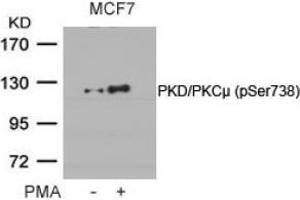 Image no. 2 for anti-Protein Kinase D1 (PRKD1) (pSer738) antibody (ABIN196754) (PKC mu anticorps  (pSer738))
