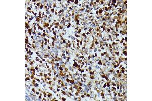 Immunohistochemistry of paraffin-embedded human appendix using DUT antibody (ABIN7266736) at dilution of 1:100 (40x lens).