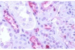 Human Kidney: Formalin-Fixed, Paraffin-Embedded (FFPE)