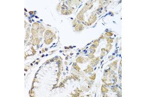 Immunohistochemistry of paraffin-embedded human stomach using IFNL3 antibody (ABIN6293714) at dilution of 1:100 (40x lens). (IL28B anticorps)