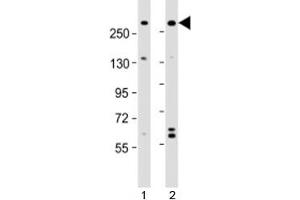 Western blot testing of human 1) A431 and 2) U-2OS cell lysate with NBAS antibody at 1:2000. (NBAS anticorps  (AA 628-661))