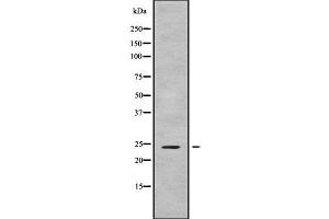 Western blot analysis FGF9 using Jurkat whole cell lysates (FGF9 anticorps  (N-Term))