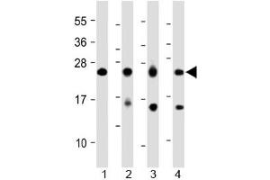 Western blot testing of 1) human heart, 2) human skeletal muscle, 3) mouse skeletal muscle and 4) rat skeletal muscle lysate with MYL1 antibody at 1:2000.