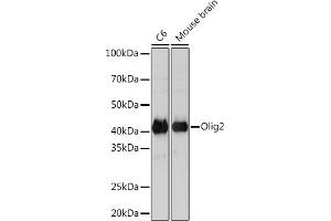 Western blot analysis of extracts of various cell lines, using Olig2 Rabbit mAb (ABIN7269090) at 1:1000 dilution.